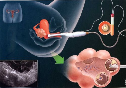 广州三代试管助孕：母乳不足也不能频繁喂养！请注意这几种情况